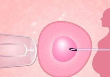 40岁做试管婴儿的的流程是什么？40岁做试管婴儿自然周期取卵还是常规取卵？